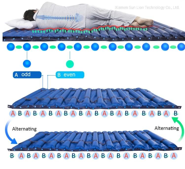 Hospital Bedridden Patients Care Inflatable Air Mattress with Pump