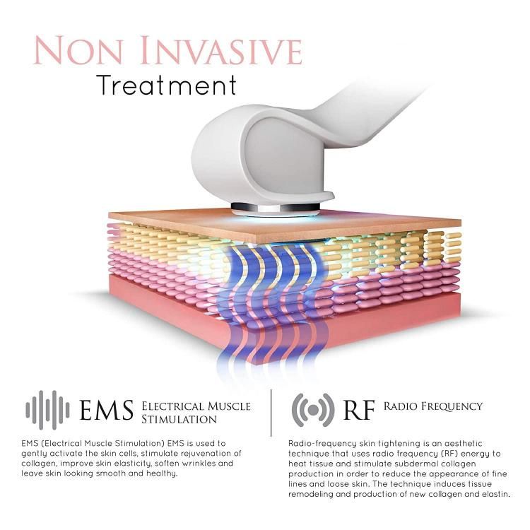 2022 Health Care Vibration Electric Vibrating RF EMS Eye Facial Massager