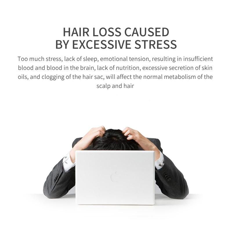 Portable Hand Held Hair Growth Scalp Head Massager