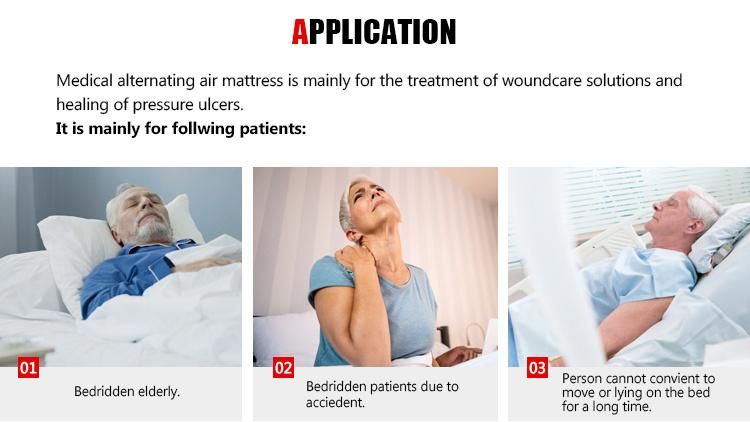 Alternating Pressure Mattress for Bed Sores